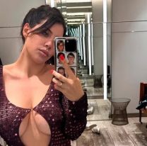 Moretones en en el cuerpo: Wanda Nara mostró fotos en Instagram sobre su estado