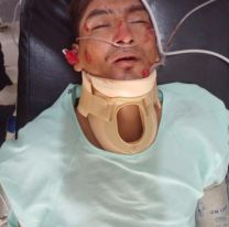 Urgente: Jujeño chocó con su moto quedó muy mal y no encuentran a su familia