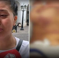 Denunció que su ex la atropelló con el auto y mostró las grave heridas [VIDEO]