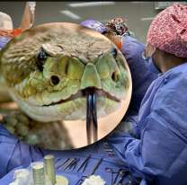 Bebita fue mordida por una serpiente y está grave: tiene 1 añito