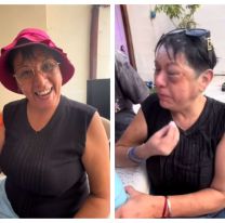"Hola soy Carla y...": Jujeña terminó desfigurada tras los festejos del finde
