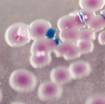 Un peligrosa bacteria causó un brote en Chile: ¿qué es el Vibrio parahaemolyticus?