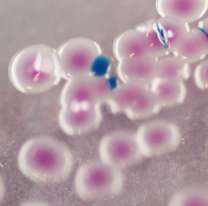 Un peligrosa bacteria causó un brote en Chile: ¿qué es el Vibrio parahaemolyticus?