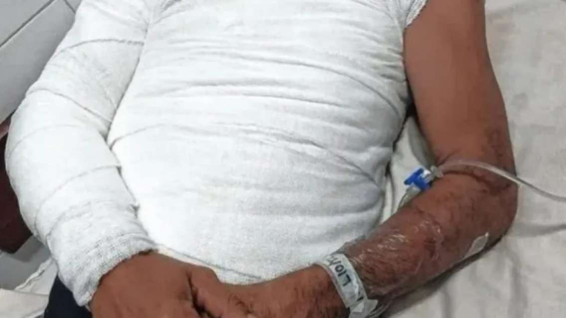 Dos hermanos se pelearon por un sachet de mayonesa y uno terminó internado