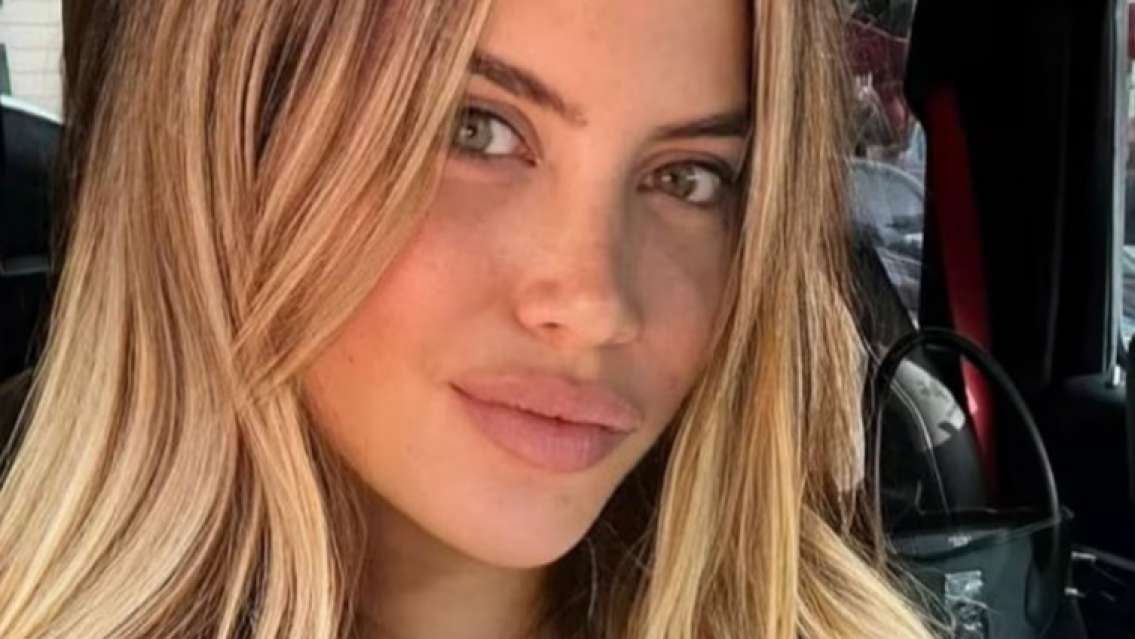 Se filtró la cirugía que se realizó Wanda Nara en medio del escándalo con Mauro Icardi