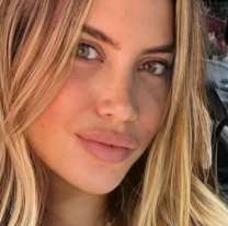 Se filtró la cirugía que se realizó Wanda Nara en medio del escándalo con Mauro Icardi