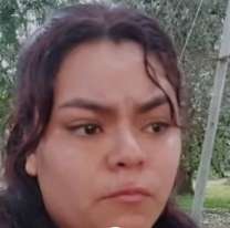 Bianca es jujeña y necesita la ayuda de todos para operarse de la cadera