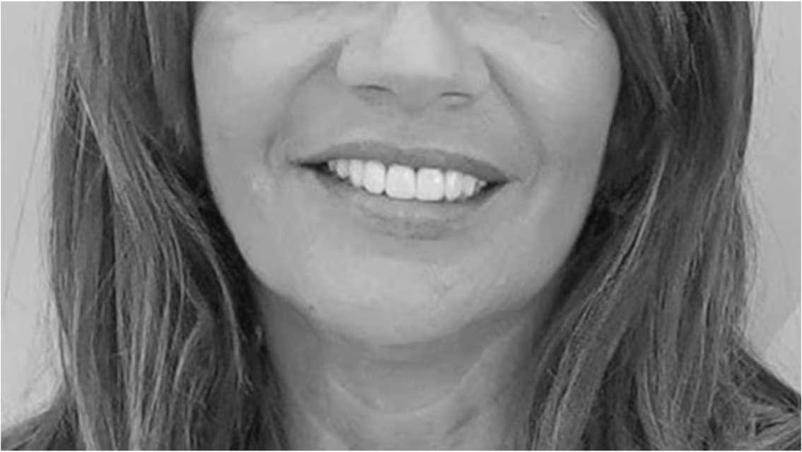 Murió una empresaria tras una operación estética: "Desde el segundo día..."