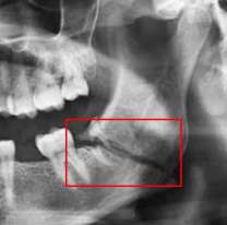 Jujeño enloqueció y le rompió la mandibula a su ex: Quedó internada