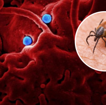 Yezo: cómo es el nuevo virus que puede contagiarse aún al aire libre