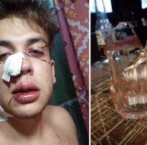 Violento ataque a un joven en un boliche norteño, le estallaron un vidrio en la cara