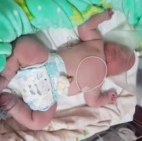 Cerca de Jujuy nació un "Súper Bebé", cuánto pesó y cómo está su mamá