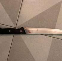 Muy grave: un joven fue acuchillado en medio de una pelea