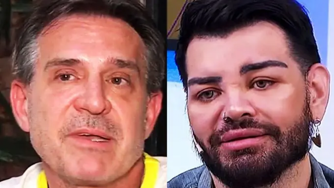 Otra más del "doctor" Lotocki, le arruinó el rostro a un ex Cuestión de Peso