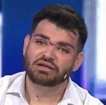 Internaron de urgencia a Fran Mariano. Es otra víctima de Lotocki. ¿Hasta cuándo?