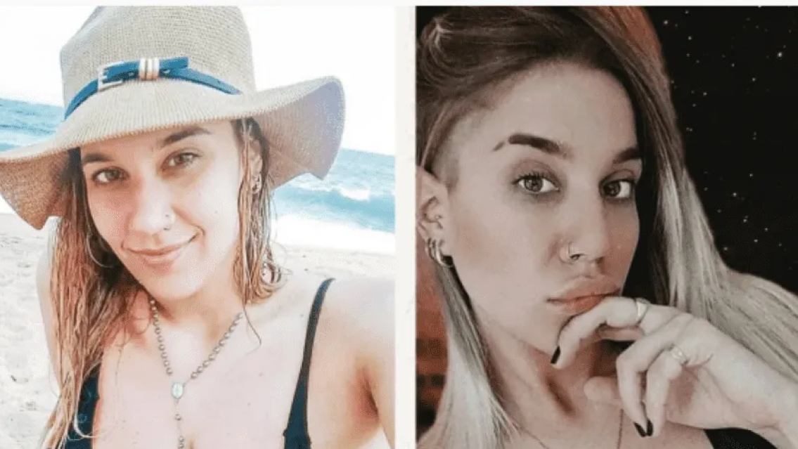 Impactante "antes y después" de La Tora de Gran Hermano, se hizo otra cirugía