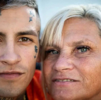 Cómo quedó la mamá de L-Gante después de hacerse un retoque estético