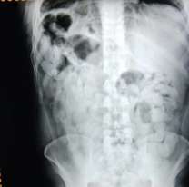 "Nos duele mucho la panza": salieron de Jujuy y lo que se tragaron los dejó en el peor estado