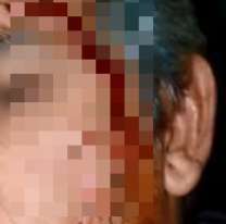 En el día del trabajador, taxista terminó bañado de sangre y muy triste